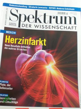 Artikelbild des Artikels “7/2002 Herzinfarkt, neue Resultate enthüllen die wahren Ursachen “