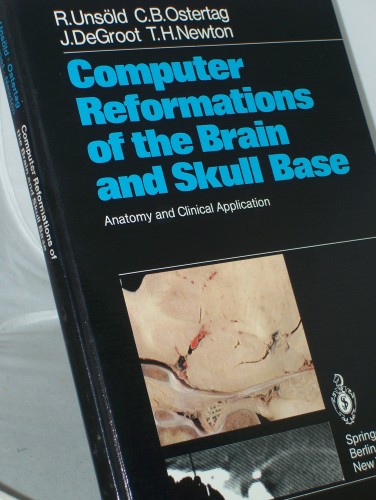 Artikelbild des Artikels “Computer reformation of the brain and skull base : anatomy and clin.
application / R. Unsöld... “