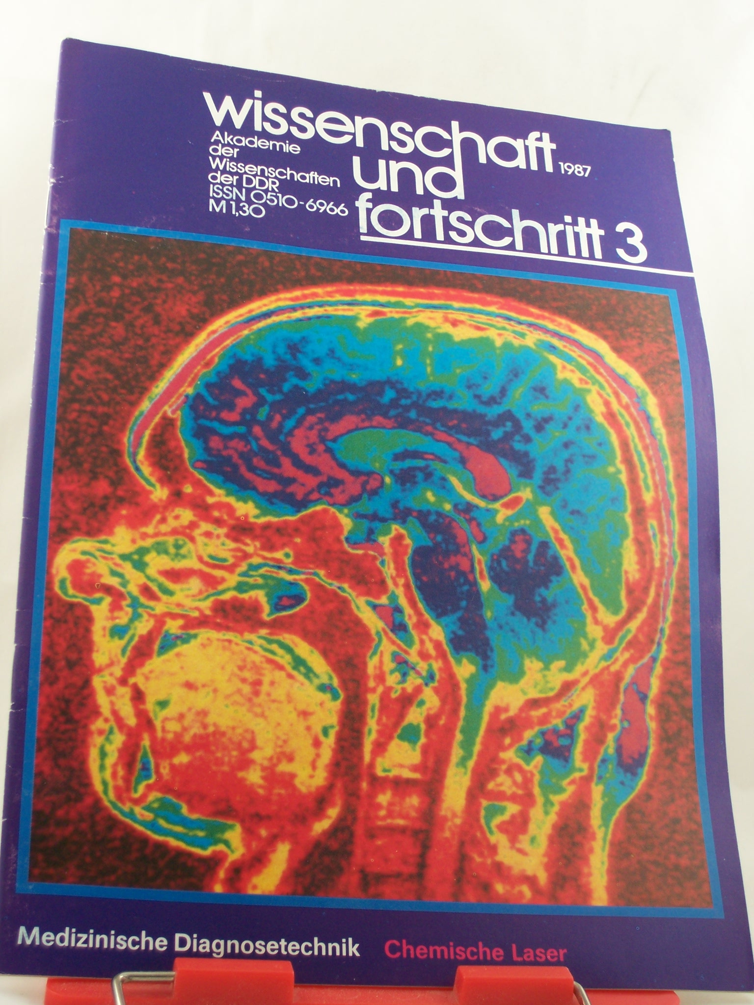 Artikelbild 1 des Artikels “Wissenschaft und Fortschritt, 3/1987 “
